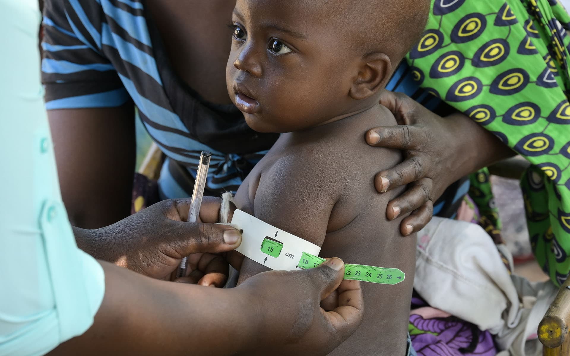 CH1683517 Chisomo, 1 Year Old, Mobile Health Clinic, Malawi